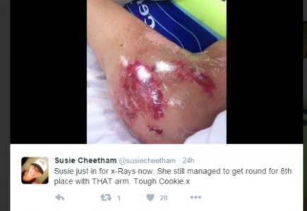 susie cheetham injury1